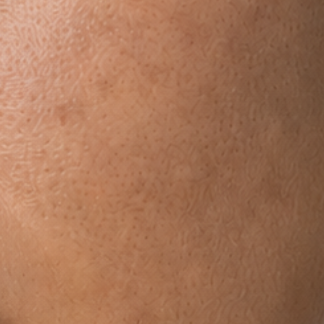 Dull & Uneven Skin