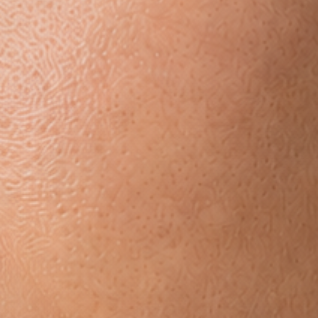 Normal to Combination Skin