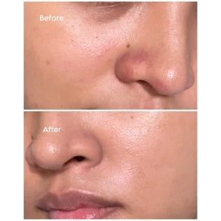 HANEUL Luminous Radiance Combo (Brightening Serum 30ml + Brightening Moisturizer 50g)